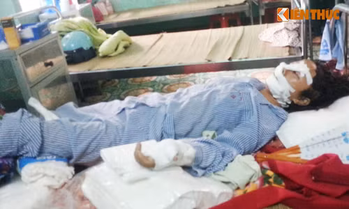 Chòng cát gan tay, gan chan vọ: Nạn nhan dã tỉnh lại