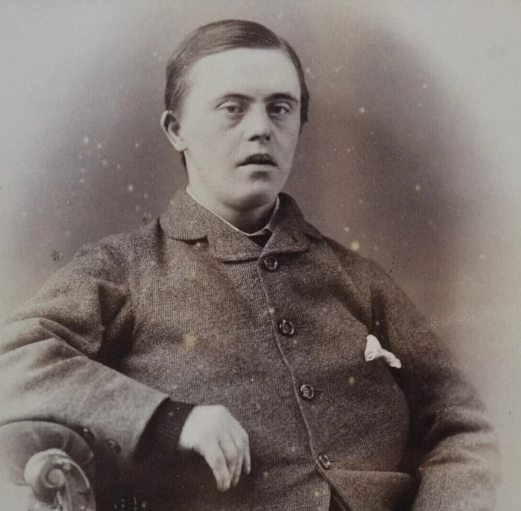 Người đàn ông mắc hội chứng Down những năm 1890.