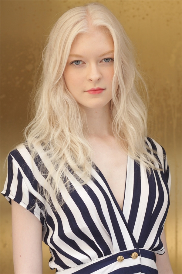 Những người bạch tạng cũng giống như chúng ta, họ đều có mưu cầu được hạnh phúc và khao khát được yêu thương. Hãy cùng bảo vệ và đối xử công bằng với tất cả mọi người, tất cả các sắc tộc, màu da.