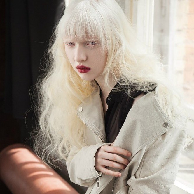 Khi còn nhỏ, những người mẫu này đều bị kỳ thị rất nhiều, nhận những ánh mắt, sự đánh giá, trêu chọc. Thậm chí gia đình Connie Chiu phải giấu con gái đi, cắt đi mái tóc bạch kim của cô và chuyển đến Thụy Điển sống vì tự ti. Nhưng sau đó, nhờ sự mở lòng và hiểu biết con mọi người, những người bạch tạng đã tự tin hơn, thể hiện vẻ đẹp tài năng và ngoại hình của mình.