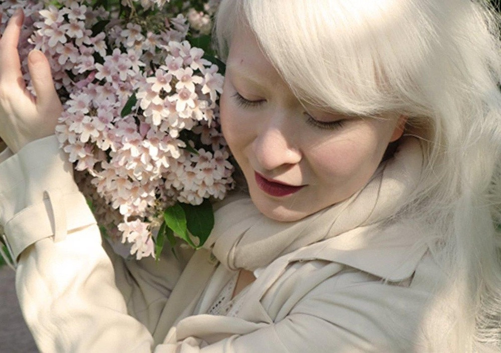 Nhưng may mắn thay, nhờ sự phát triển khoa học và hiểu biết của con người cũng như sức mạnh truyền thông, người bạch tạng dần được bảo vệ và đối xử công bằng. Nhiều người làm nghệ thuật đã nhìn ra được những phẩm chất và nét đẹp vô cùng đặc biệt ở người bạch tạng, một vẻ đẹp mà không gì có thể so sánh nổi.