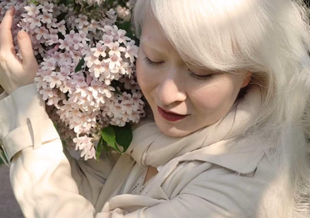 Nhưng may mắn thay, nhờ sự phát triển khoa học và hiểu biết của con người cũng như sức mạnh truyền thông, người bạch tạng dần được bảo vệ và đối xử công bằng. Nhiều người làm nghệ thuật đã nhìn ra được những phẩm chất và nét đẹp vô cùng đặc biệt ở người bạch tạng, một vẻ đẹp mà không gì có thể so sánh nổi.