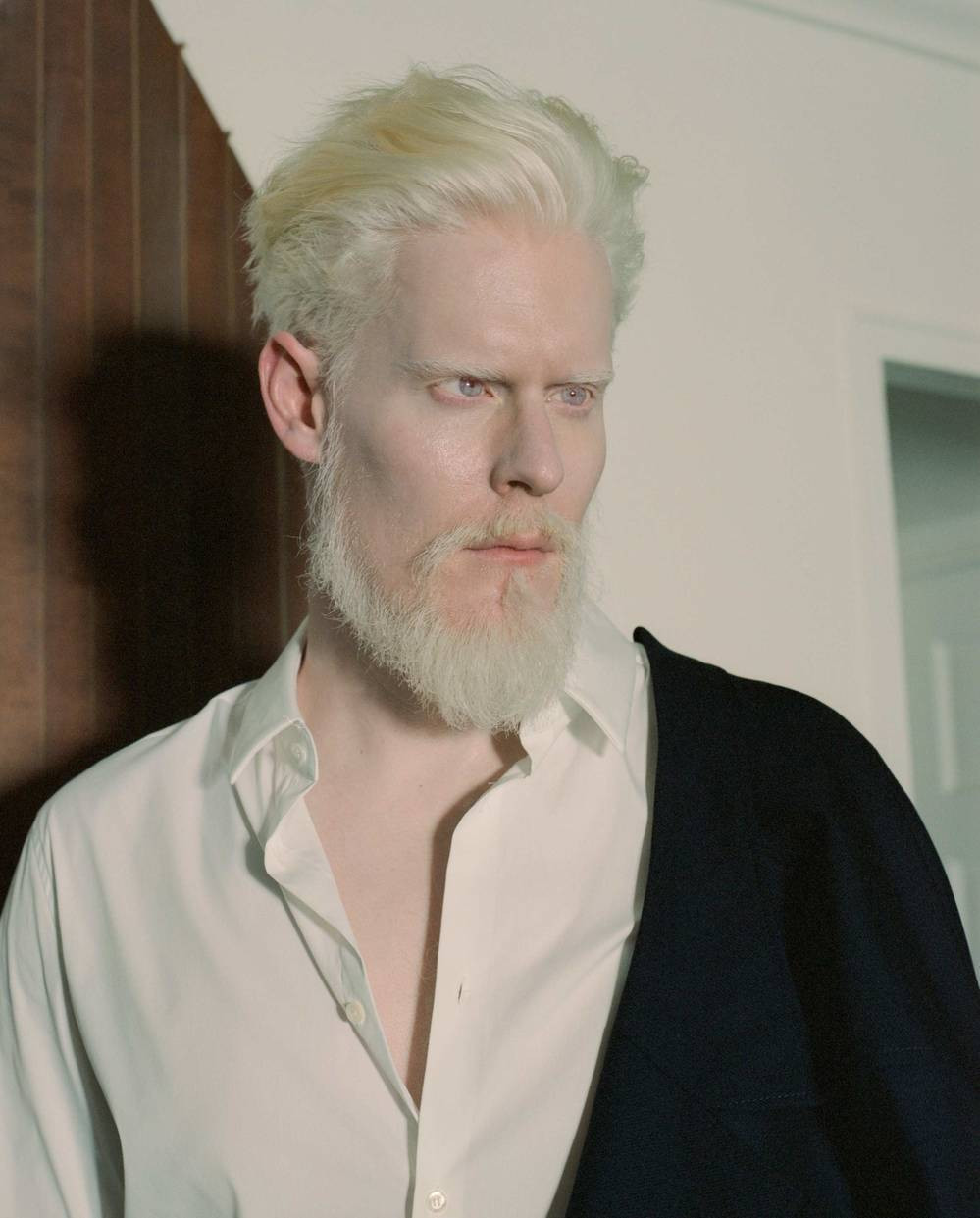 Nhiều người mẫu nổi tiếng trên thế giới cũng xuất thân từ người mắc bệnh bạch tạng. Phải kể đến người mẫu Connie Chiu (Trung Quốc), Joanna Bajena (Mỹ), Nastya Kumarova Zhidkova (Nga), Ava Clarke (cô bé người Mỹ gốc Phi),...