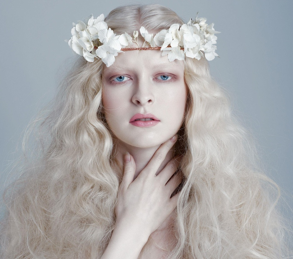 Cô gái Joanna (Mỹ) bị bạch tạng đã gặt hái được nhiều thành công với nghề mẫu. (Nguồn ảnh: Pinterest)