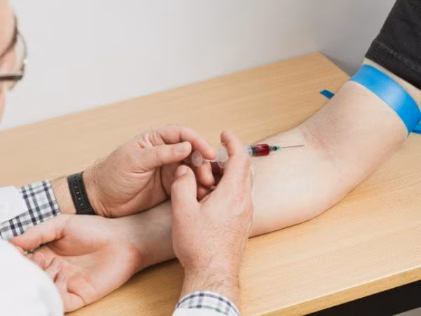  Giảm nguy cơ thừa sắt: Thừa sắt là một bệnh lý gây ra do cơ thể hấp thu sắt quá độ. Bệnh này có thể do di truyền hoặc do nghiện rượu, thiếu máu và các vấn đề khác. Hiến máu thường xuyên giúp giảm nguy cơ thừa sắt trong cơ thể.