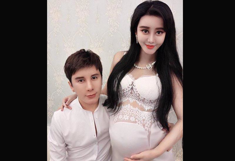 Được biết, để có được khuôn mặt giống nàng Kim Tỏa, Hà Thừa Hi mất 8 năm đau đớn thẩm mỹ, từ khi 15 tuổi và tiêu tốn hơn 8 triệu nhân dân tệ (khoảng gần 30 tỉ đồng). Hiện tại cô đã có chồng và con trai đầu lòng. Xinh đẹp nhờ thẩm mỹ, chính vì thế khi Hà Thừa Hi và Dư Tiểu Tuyền kết hôn thu hút sự chú ý của rất nhiều người. Họ tò mò về đứa trẻ - con của hai người sau khi chào đời. Liệu bé sẽ có diện mạo giống bố mẹ mình trước hay sau khi thẩm mỹ?