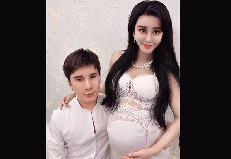 Được biết, để có được khuôn mặt giống nàng Kim Tỏa, Hà Thừa Hi mất 8 năm đau đớn thẩm mỹ, từ khi 15 tuổi và tiêu tốn hơn 8 triệu nhân dân tệ (khoảng gần 30 tỉ đồng). Hiện tại cô đã có chồng và con trai đầu lòng. Xinh đẹp nhờ thẩm mỹ, chính vì thế khi Hà Thừa Hi và Dư Tiểu Tuyền kết hôn thu hút sự chú ý của rất nhiều người. Họ tò mò về đứa trẻ - con của hai người sau khi chào đời. Liệu bé sẽ có diện mạo giống bố mẹ mình trước hay sau khi thẩm mỹ?