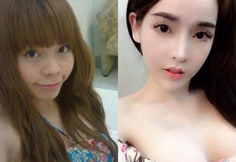 Vân Tokyo (tên thật là Tăng Ngọc Vân, sinh năm 1989) từng gây sốt cộng đồng mạng khi công khai quá trình phẫu thuật thẩm mỹ (PTTM) hồi năm 2013. Lúc ấy, tên tuổi của cô nổi ầm ầm với danh xưng hotgirl mạng xã hội.