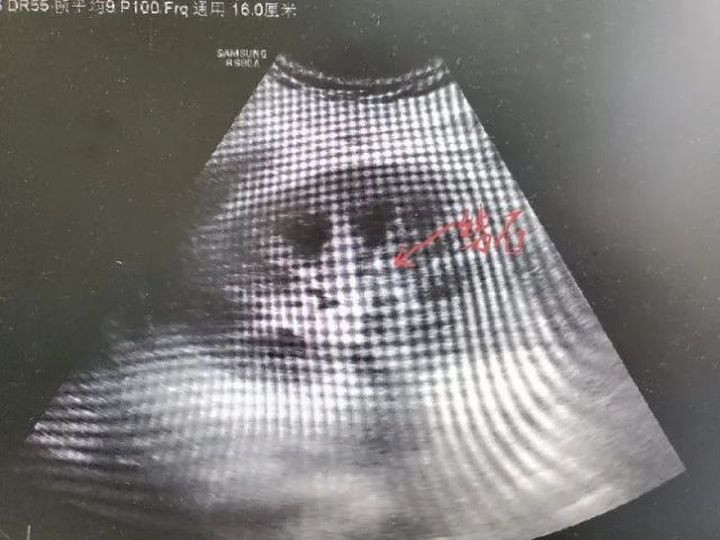 Chang trai 18 tuoi phai chay than vi moi ngay deu uong thu nay-Hinh-2