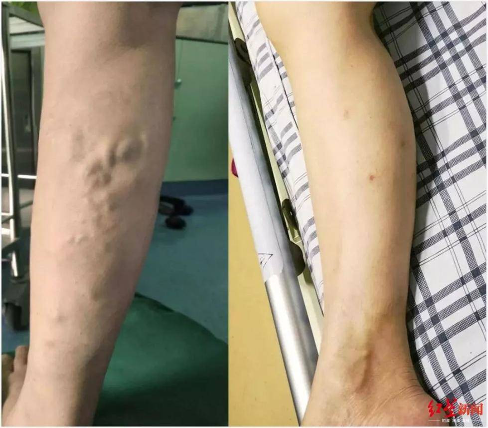 Co gai 10 nam khong dam mac vay, keo quan xuong bac si moi biet ly do