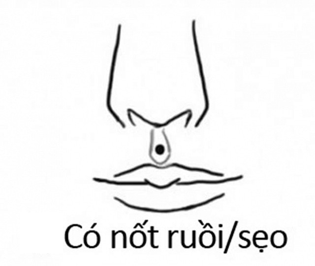 Nhan trung tot la sau hay nong, anh huong the nao den hau van?-Hinh-3