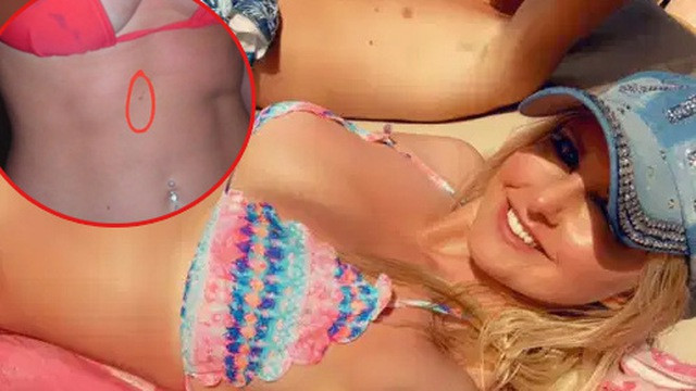 Duoc cuu mang nho thay not ruoi duoi nguc trong buc anh cu