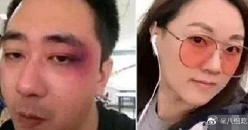 Dien vien Vuong Tu Kien bi vo danh dap tan nhan, 8 lan phai nhap vien