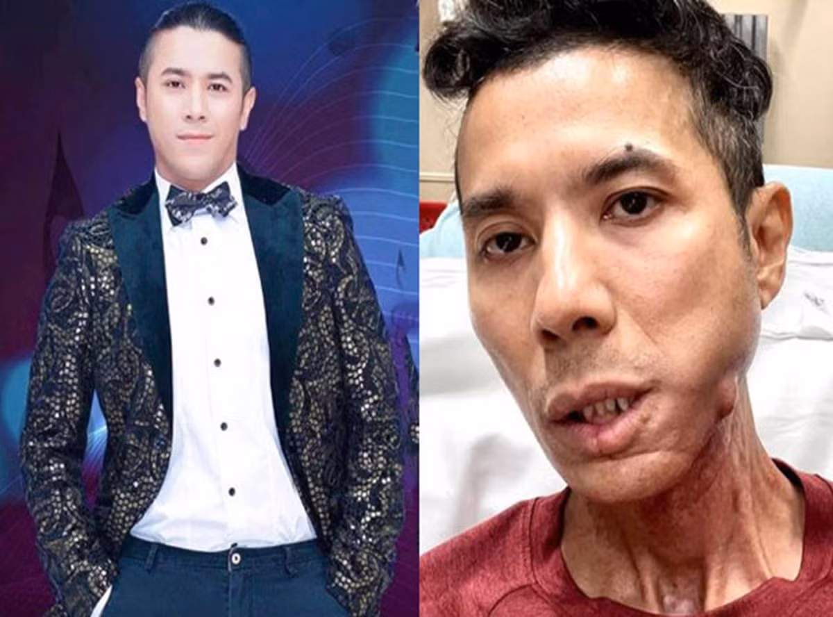 Can biet thu hai tang ven ho cua Kasim Hoang Vu o My