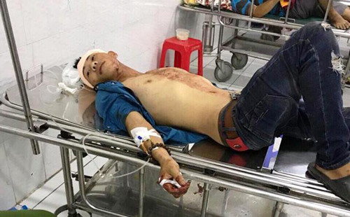 Một trong số 2 nạn nhân bị truy sát đang điều trị tại bệnh viện.