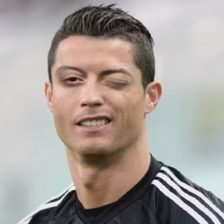 Dù ghép thêm đôi mắt trố của đồng đội cũ Oezil, trông Cristiano Ronaldo vẫn rất đẹp trai ngày nào.