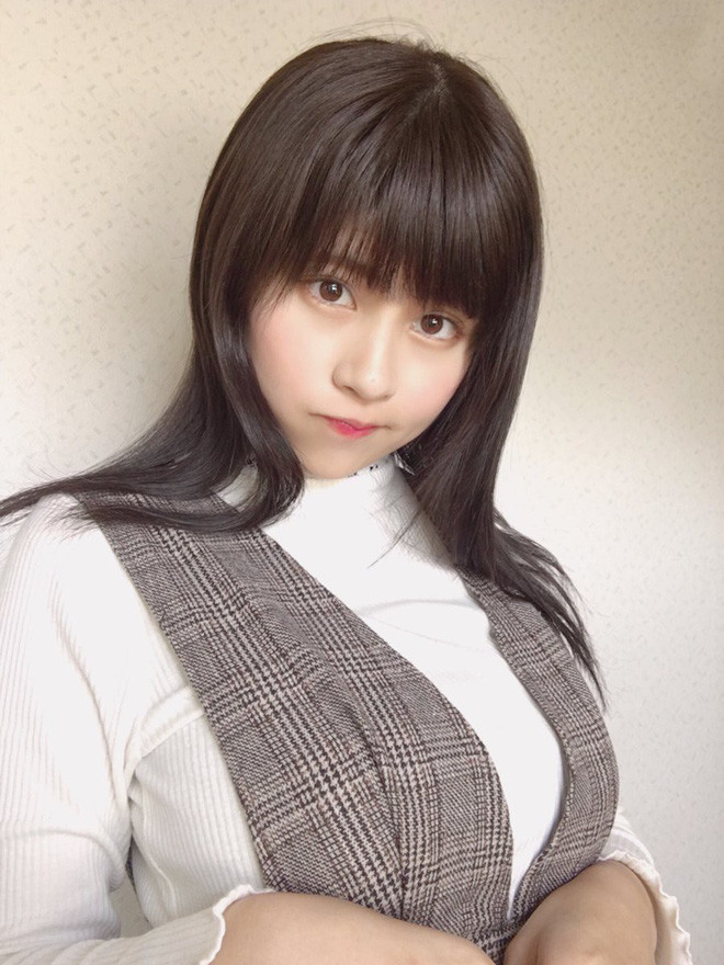 Giống như trường hợp của cô nàng hot girl lookbook đình đám của Nhật này chẳng hạn, vì chiếc răng khôn mà gương mặt v.line ngày nào giờ trở thành u.line ú ụ thịt.