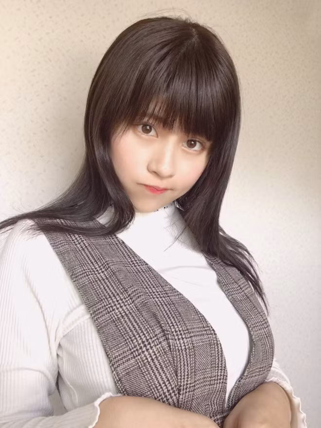 Giống như trường hợp của cô nàng hot girl lookbook đình đám của Nhật này chẳng hạn, vì chiếc răng khôn mà gương mặt v.line ngày nào giờ trở thành u.line ú ụ thịt.