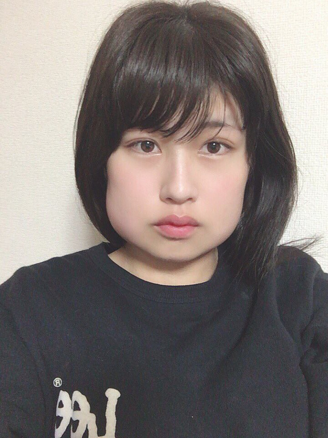 Mọc răng khôn là điều mà bất cứ ai trong đời cũng phải trải qua. Đau đớn thôi thì chưa nói nhưng hậu quả chiếc răng này gây ra đôi lúc còn khiến nhiều bạn trẻ "khóc dở, mếu dở".