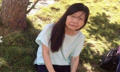 Cô gái 21 tuổi có gương mặt già nua gây chú ý trên mạng.