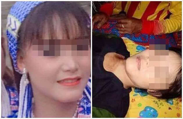 My nhan Myanmar 19 tuoi chet tham vi cam nham sung that dong canh tu sat