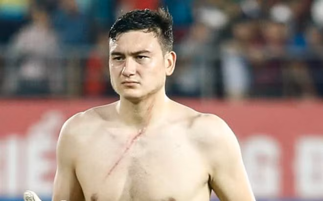 Hiện tại, CLB Hải Phòng cũng đã báo cáo về vụ việc này. Quyền quản lý con người thuộc về họ còn lãnh đạo liên đoàn sẽ phải chờ xem. Nhưng chắc chắn VFF sẽ xử lý vụ việc này đến cùng. Ảnh: Zing.