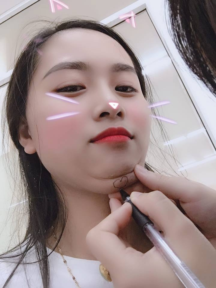 Thực ra, cằm nọng từng là nỗi khổ tâm của rất nhiều người. Luôn có kiểu người mà ăn bao nhiêu cũng chỉ mập mỗi mặt. Lắm khi người thì rõ ràng là thon thả, mảnh mai vậy mà cằm lúc nào cũng đầy đủ nọng lớn, nọng bé.