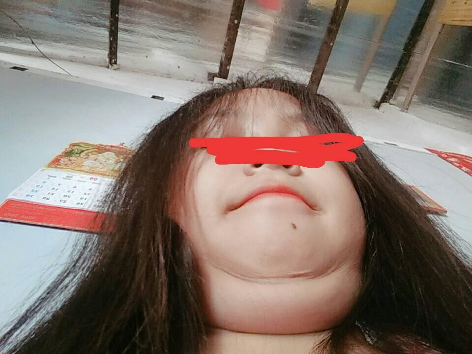 Cả thế giới cứ việc V-line đi, cằm nọng của tôi đang là hot trend.