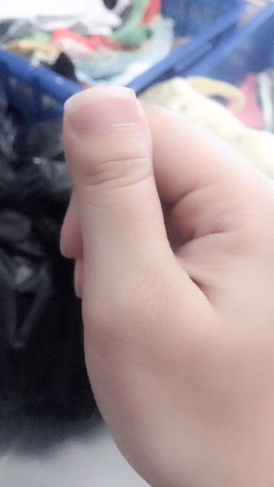 Chiều cao con người có thể lùn vì vậy chẳng có lý do gì mà ngón tay ngón tay không có thể bị "nấm lùn".