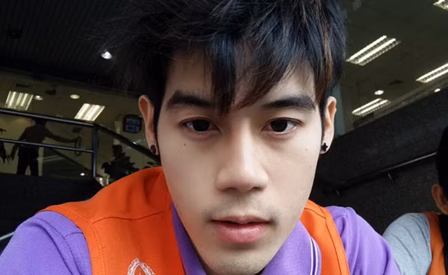 Nhưng sau đó, anh chàng xe ôm đẹp trai khiến nhiều người bất ngờ khi tung bức ảnh phẫu thuật thẩm mỹ để tiếp tục cải thiện nhan sắc.