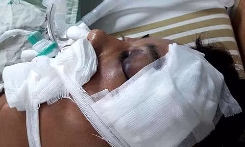 Chay canh sat, nguoi Viet o Dai Loan roi tu tang 4