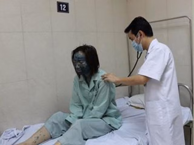 Bên cạnh đó, các thành viên khác cũng chia sẻ những hình ảnh mình bị thủy đậu mà cả người bị bôi thuốc xanh methylen chẳng khác gì người ngoài hành tinh.