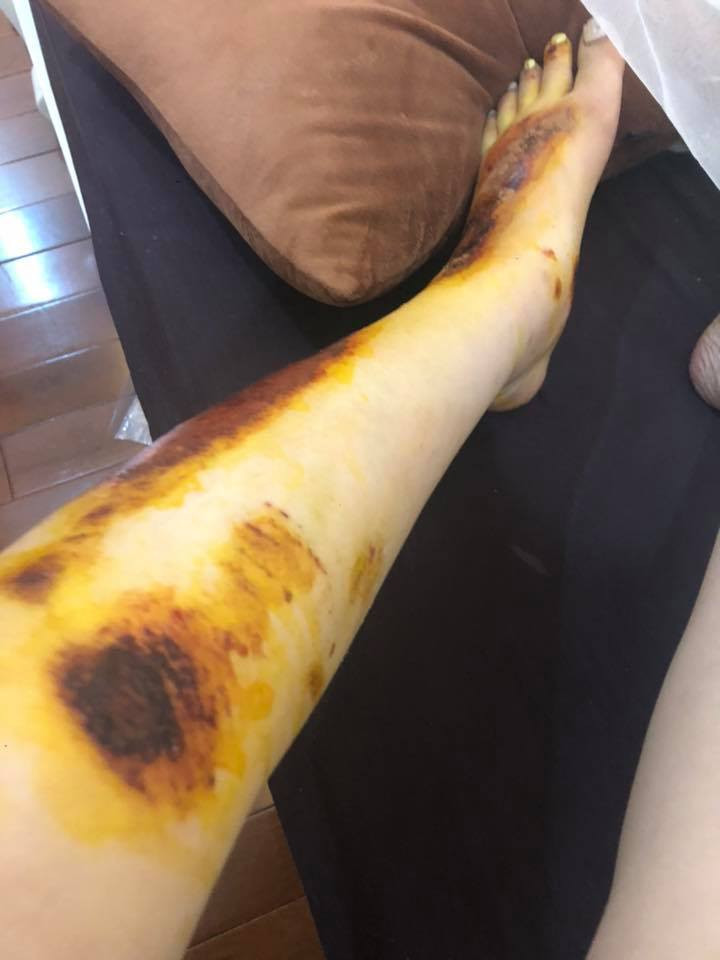 Cuối bài đăng, nickname T.D nhắn nhủ các cô gái trẻ ra đường nên chú ý hơn vì những tên biến thái ẩn mình khắp nơi. Không chỉ có những nơi kín đáo như thang máy mà chúng còn ở cả ngoài đường với những thủ đoạn tinh vi và xảo trá hơn.