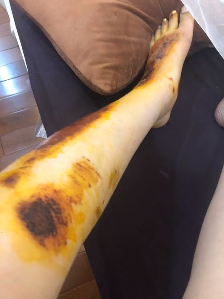 Cuối bài đăng, nickname T.D nhắn nhủ các cô gái trẻ ra đường nên chú ý hơn vì những tên biến thái ẩn mình khắp nơi. Không chỉ có những nơi kín đáo như thang máy mà chúng còn ở cả ngoài đường với những thủ đoạn tinh vi và xảo trá hơn.