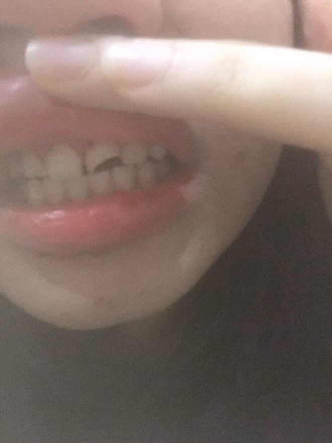 Sự việc chỉ kết thúc khi nạn nhân cởi khẩu trang và nhổ máu cùng chiếc răng bị gẫy ra ngoài thì gã biến thái trên đường mới rời đi. Hắn vội vàng phóng mất mà không để lại một lời xin lỗi nào.