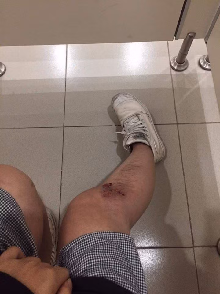 Đứng trước sự việc tên biến thái sàm sỡ trên, đa phần dân mạng đều bất ngờ với hành động của tên yêu râu xanh này. Nhiều cô gái còn tỏ ra hoang mang.