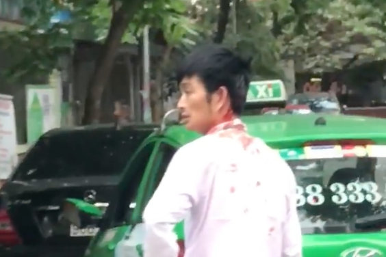 Ngay sau khi xuất hiện trên mạng xã hội, clip về vụ ẩu đả giữa tài xế taxi và thanh niên đi xe sang trên đã thu hút sự chú ý của cộng đồng mạng. Theo nhiều người họ ủng hộ hành động dám lên tiếng của tài xế taxi khi nhắc nhở chủ xe.