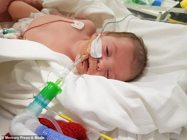 Lai la “nu hon than chet” khien be 8 tuan tuoi doi mat tu than