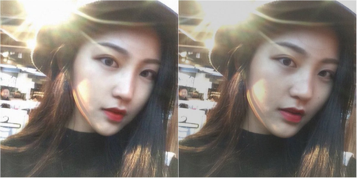 Mũi to có lộc hay không chưa biết chứ mũi nhỏ chắc chắn sẽ khiến bạn trông xinh hơn rồi.