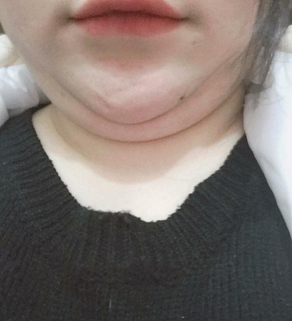 Còn nickname Minh Anh thì lại cho rằng: "Có ai định yêu người hai cằm như em không? Người thì tong teo, ăn bao nhiêu lên mỗi cái mặt. Cột tóc lên là bị nói mặt giống cái đĩa, lại phải xõa."