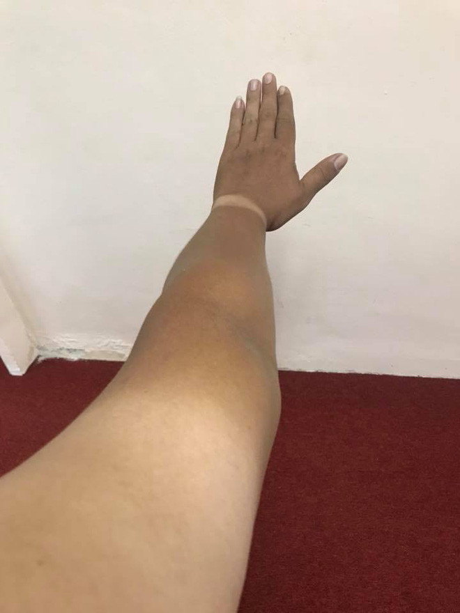 Phải mất bao lâu để lấy lại làn da trắng sáng của ngày xưa.