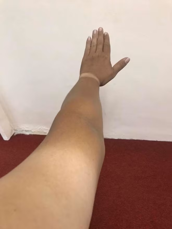 Phải mất bao lâu để lấy lại làn da trắng sáng của ngày xưa.