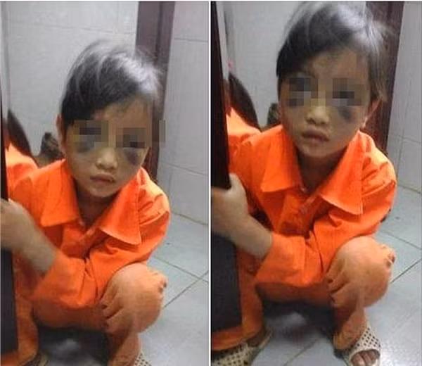 Tước đó, tháng 3/2016, cháu P.C.T. - học sinh lớp 1, trường tiểu học xã Phìn Ngan (Bát Xát, Lào Cai) bị cô giáo Trần Thị Thu Trà bạo hành trường học khiến cháu bị tím mặt mũi trong giờ học do em này viết sai chính tả và viết chậm.