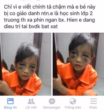 Một số em học sinh cùng lớp kể, trong giờ tập viết, T. viết bài chậm đã khiến cô giáo bực tức, nổi nóng và tát cháu T. nhiều cái vào mặt. Tại buổi họp Hội đồng kỷ luật, cô giáo Trà cho biết, mình đánh học sinh T. vào đầu, thái dương,... Vật dụng cô giáo dùng để đánh là thước kẻ, gậy tre và điện thoại.