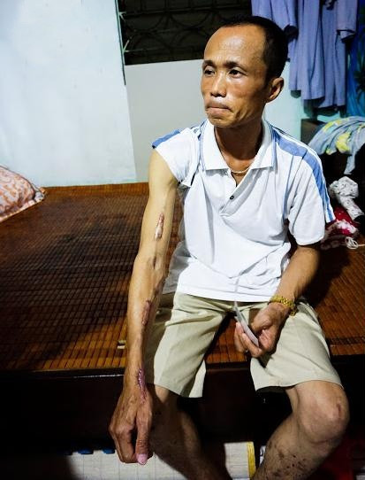 Chuyen vui buon cua nhung manh doi bat hanh o xom chay than-Hinh-2