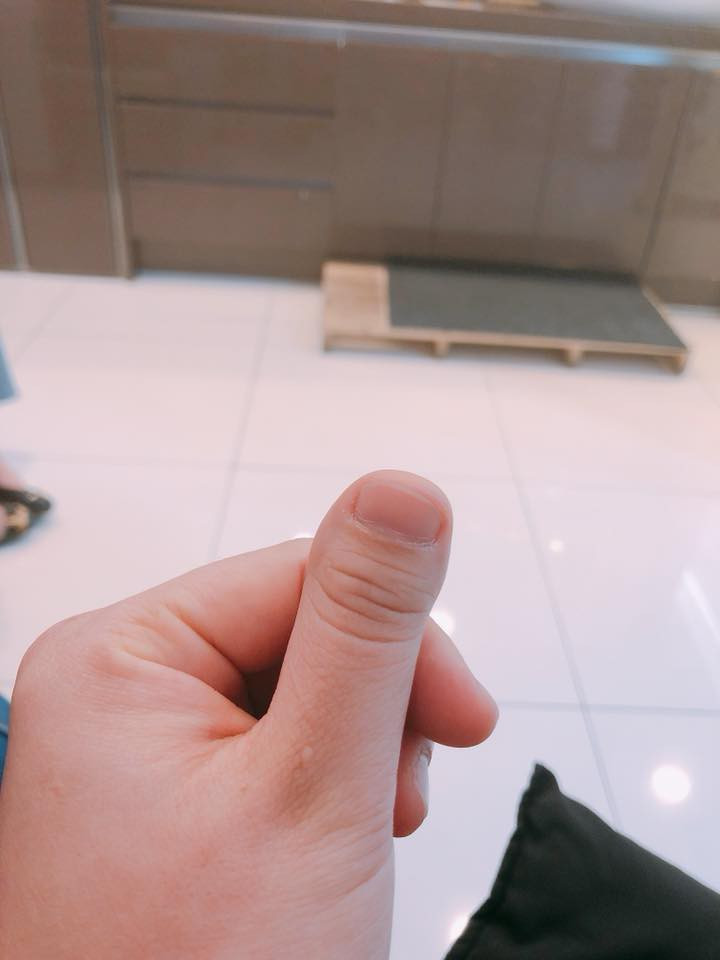 Chỉ xuất phát từ việc khoe ngón tay cái của mình khá khác lạ nhưng chính nickname Lê Hiền cũng không ngờ được rằng chính mình là người tạo ra trào lưu mới cho dân mạng và thu hút được sự hưởng ứng rất nhiệt tình nhất là những nam thanh nữ tú có chung cảnh ngộ với cô bạn.