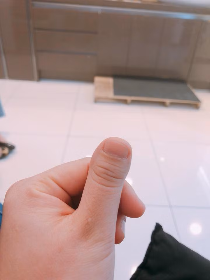 Chỉ xuất phát từ việc khoe ngón tay cái của mình khá khác lạ nhưng chính nickname Lê Hiền cũng không ngờ được rằng chính mình là người tạo ra trào lưu mới cho dân mạng và thu hút được sự hưởng ứng rất nhiệt tình nhất là những nam thanh nữ tú có chung cảnh ngộ với cô bạn.