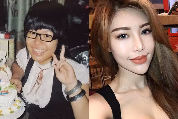 Cô gái được nhắc tới đó là Lưu Trúc Khanh (sinh năm 1994, hiện đang sống tại TP HCM). Cô nàng từng có thời gian sở hữu thân hình "hộ pháp", cùng với đó là làn da đen sạm kém thẩm mỹ.