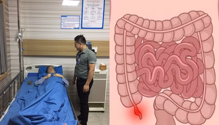 Cuu song mot benh nhan nguoi nuoc ngoai vo ruot thua nguy kich