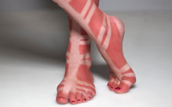 Nhiều dân mạng có đùa nhau dưới những bức ảnh cháy nắng rằng: "Mùa hè tới thì muốn xăm hình gì lên người, chỉ việc đeo hình đó lên người rồi "ra nắng chơi" là được".